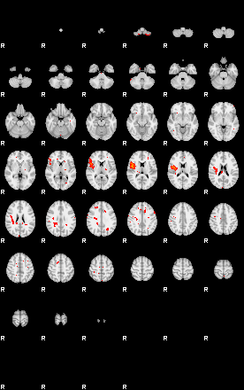 Patients 29015 153