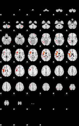 Patients 29070 133