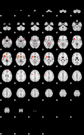 Patients 29097 129