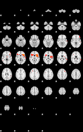 Patients 29100 171