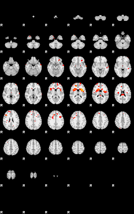 Patients 29100 58