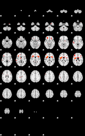 Patients 29101 131