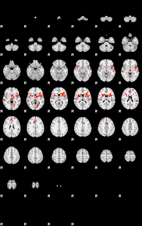 Patients 29183 62