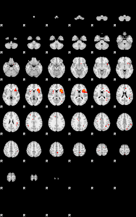 Patients 29184 181