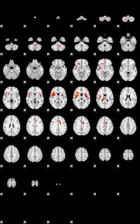 Patients 29201 143