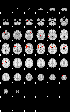 Patients 29205 157