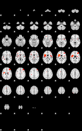 Patients 29208 143