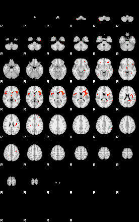 Patients 29401 176