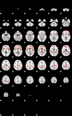 Patients 29408 50