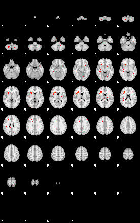 Patients 29516 130