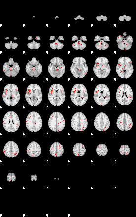 Patients 29609 95