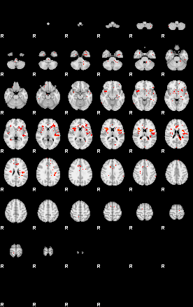 Patients 30187 60