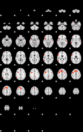 Patients 28761 96