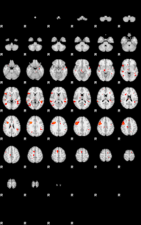 Patients 29183 94