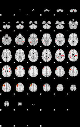 Patients 29185 198