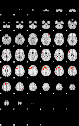 Patients 30175 4