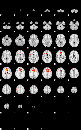 Patients 29180 63