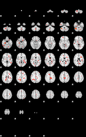 Patients 28681 78