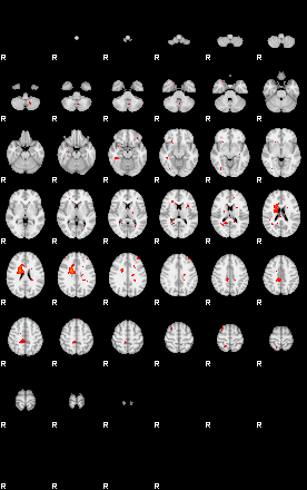 Patients 28810 28