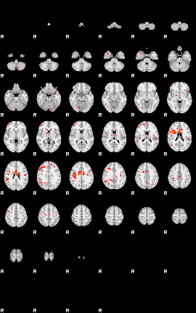 Patients 28931 142