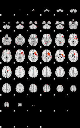 Patients 28966 66