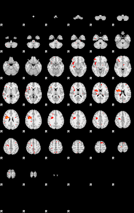 Patients 29010 152