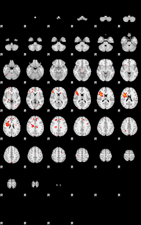 Patients 29015 147