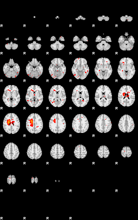 Patients 29053 26