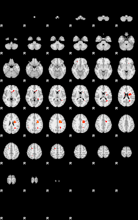 Patients 29070 159