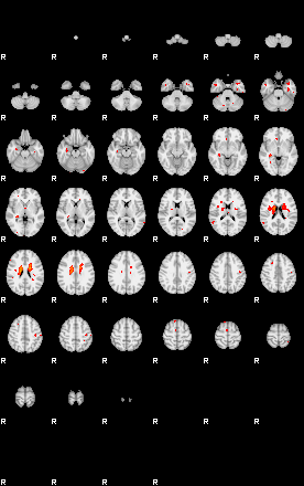 Patients 29154 26