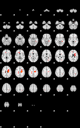 Patients 29159 174