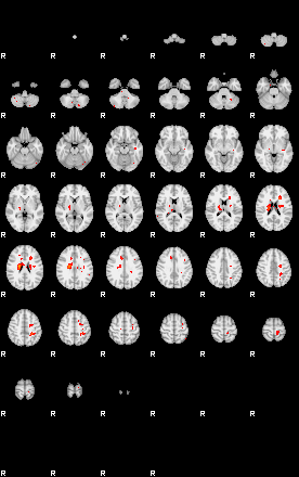 Patients 29160 25