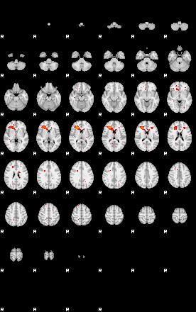 Patients 29168 127