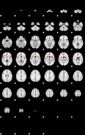 Patients 29171 58