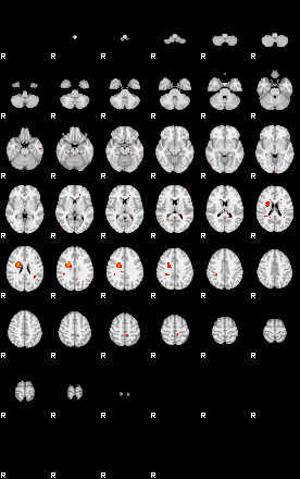 Patients 29176 25