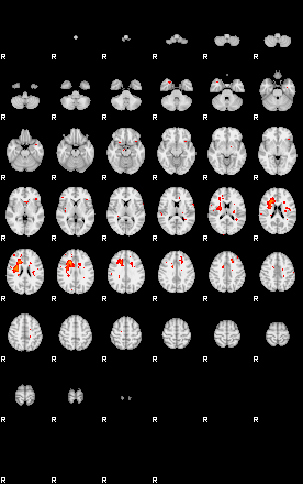 Patients 29180 177