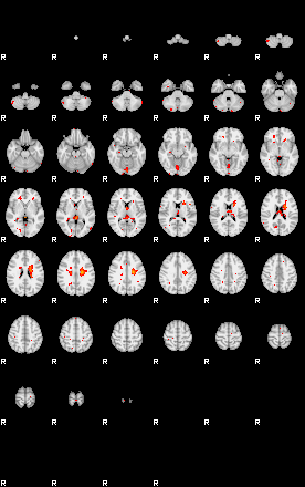 Patients 29188 178