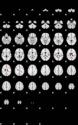 Patients 29201 25