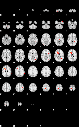 Patients 29203 13