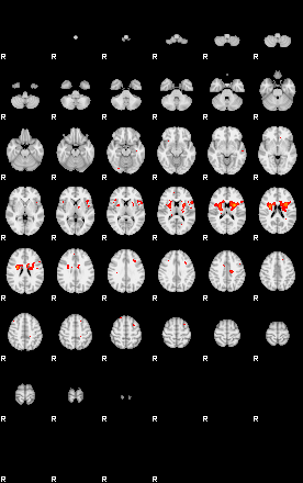 Patients 29216 143