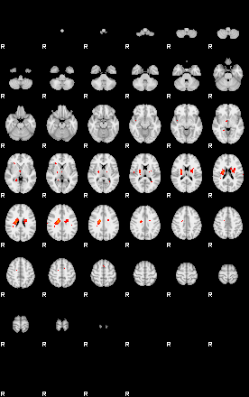 Patients 29510 163