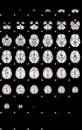 Patients 29511 169