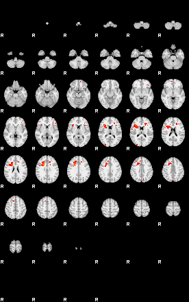 Patients 29515 129