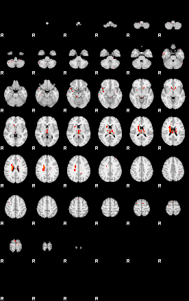 Patients 29515 22