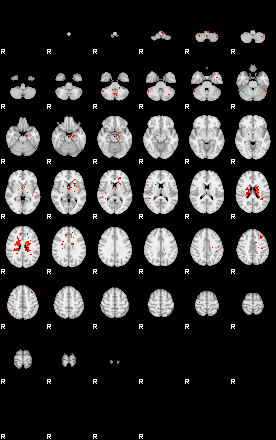 Patients 29539 193