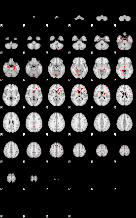 Patients 29613 100