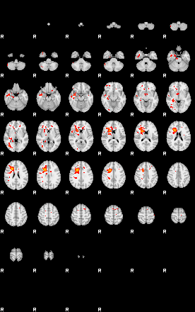 Patients 29729 185