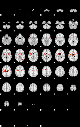 Patients 29732 22