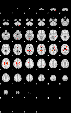 Patients 29182 196