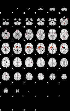 Patients 29170 147